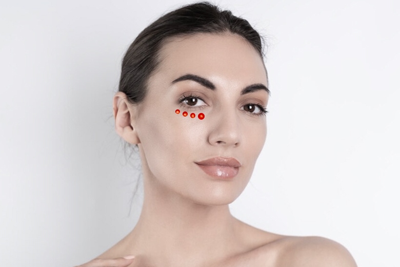 CORRECCIÓN DE OJERAS